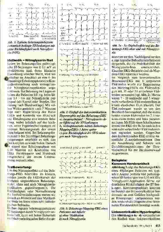 Vorschauseite 2: Das pathologische Belastungs-EKG - Möglichkeiten zur Differentialdiagnostik