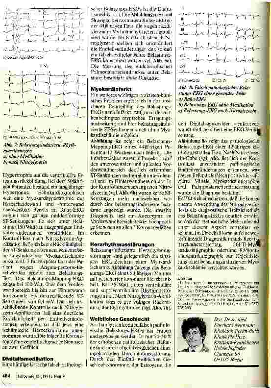 Vorschauseite 3: Das pathologische Belastungs-EKG - Möglichkeiten zur Differentialdiagnostik