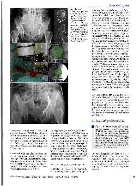 Vorschauseite 2: Navigation in der Beckenund Acetabulumchirurgie