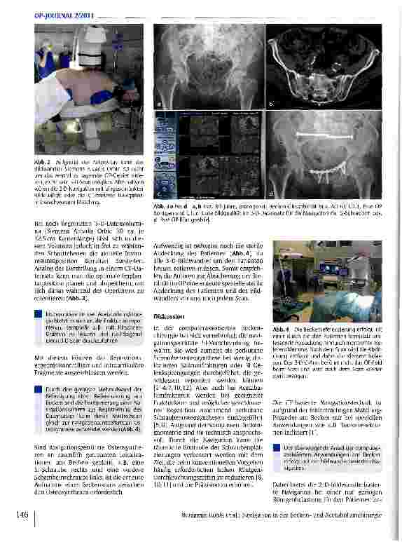 Vorschauseite 3: Navigation in der Beckenund Acetabulumchirurgie