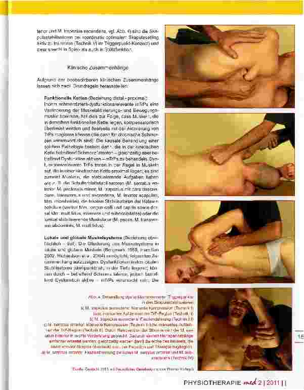 Vorschauseite 5: Funktionsstörungen der Motorik Bedeutung myofaszialer Triggerpunkte in der aktiven Rehabilitation