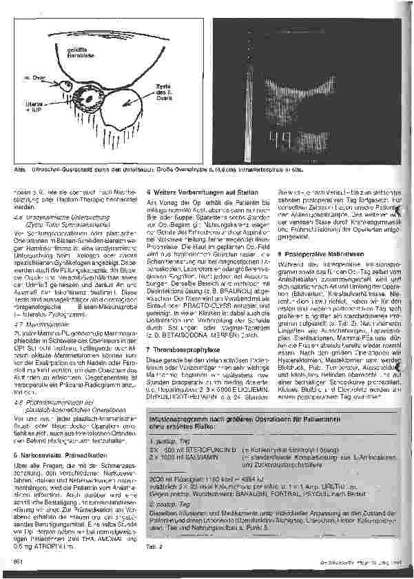 Vorschauseite 2: Präund postoperative Maßnahmen in der Gynäkologie