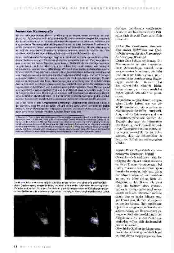 Vorschauseite 2: Qualitätsansprüche an die vorsorgliche Mammografie
