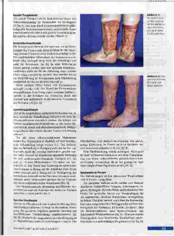 Vorschauseite 3: Evidenzbasierte Therapie chronischer Beinulzera