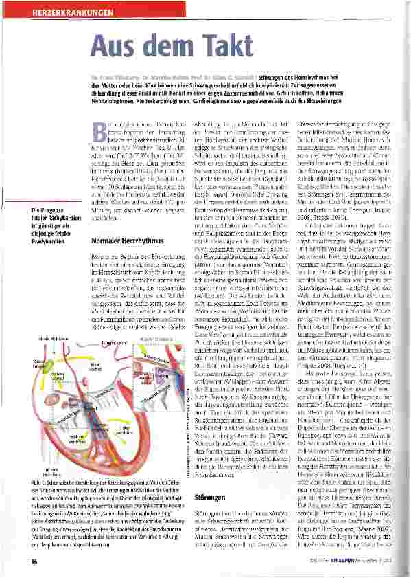 Vorschauseite 1: Aus dem Takt