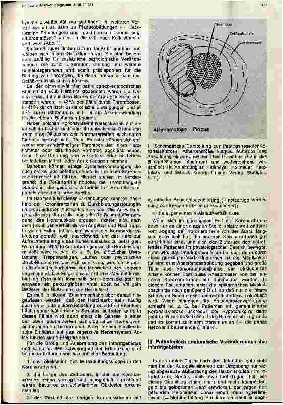 Vorschauseite 2: Der Herzinfarkt Ätiologie, Pathologie, Pathophysiologie und Klinik
