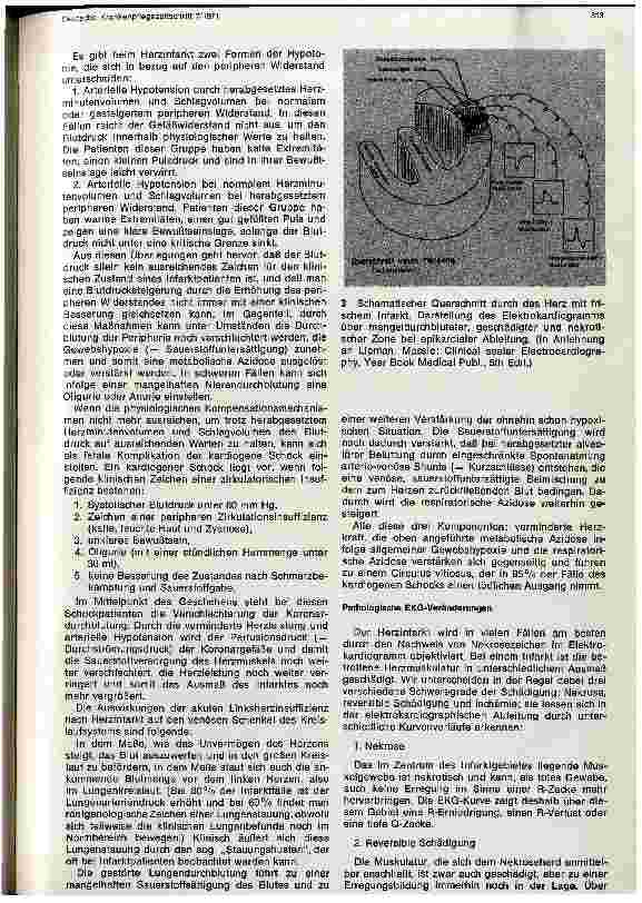 Vorschauseite 4: Der Herzinfarkt Ätiologie, Pathologie, Pathophysiologie und Klinik