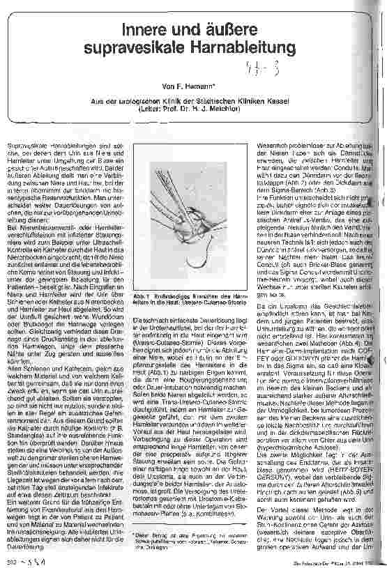 Vorschauseite 1: Innere und äußere supravesikale Harnableitung