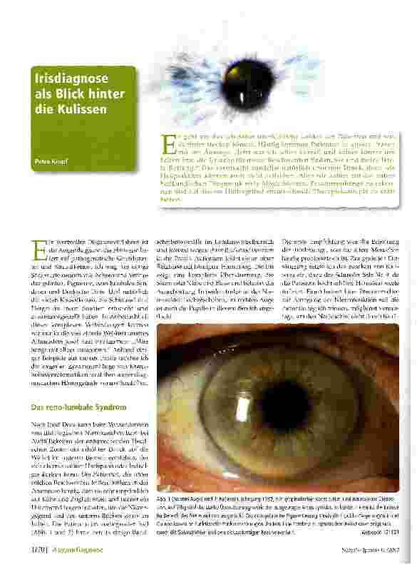 Vorschauseite 1: Irisdiagnose als Blick hinter die Kulissen