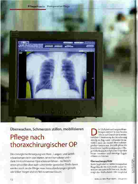 Vorschauseite 1: Pflege nach thoraxchirurgischer OP