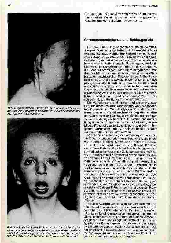 Vorschauseite 3: Die angeborenen Flügelfelle der Halsregion