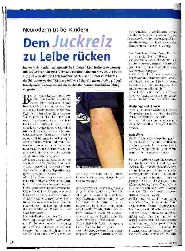 Vorschauseite 1: Dem Juckreiz zu Leibe rücken Neurodermitis bei Kindern