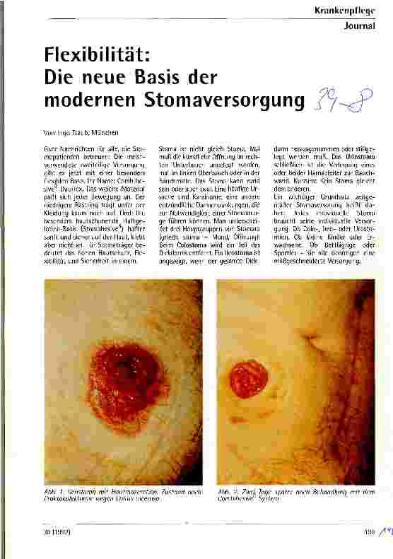 Vorschauseite 1: Flexibiltät: die moderne Basis der modernen Stomaversorgung