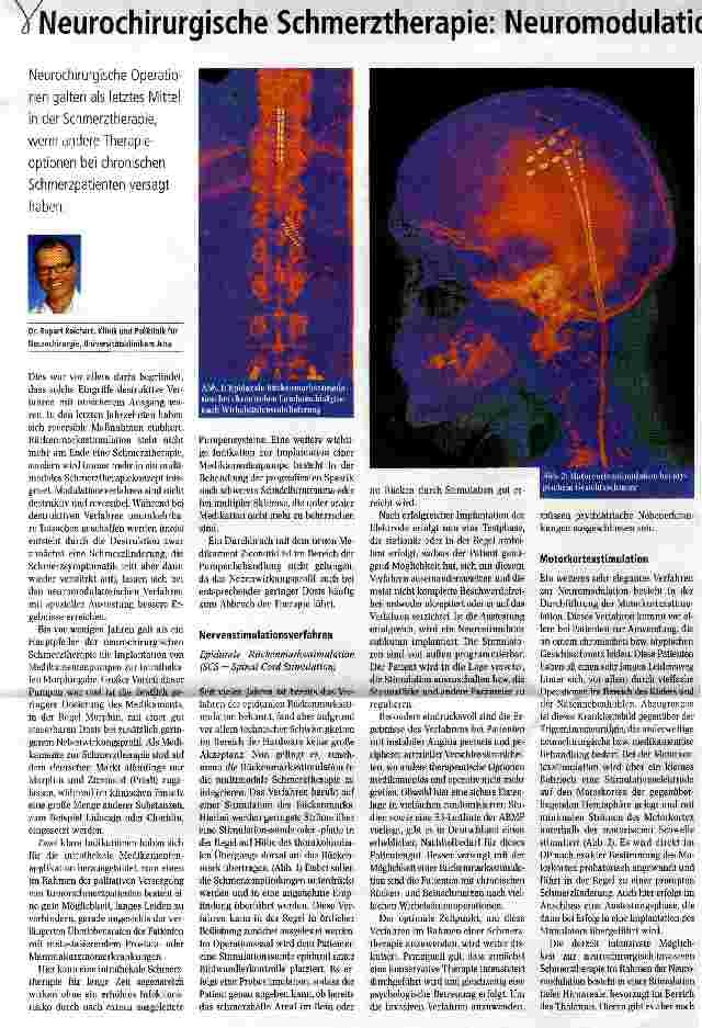 Vorschauseite 1: Neurochirurgische Schmerztherapie: Neuromodulation statt Neurodestruktion