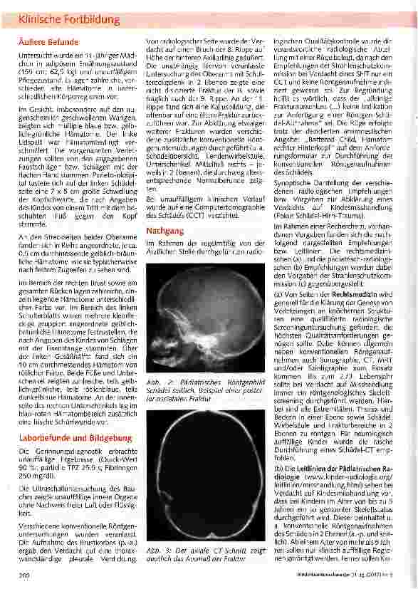 Vorschauseite 2: Diagnostik des Schädel-Hirn-Traumas