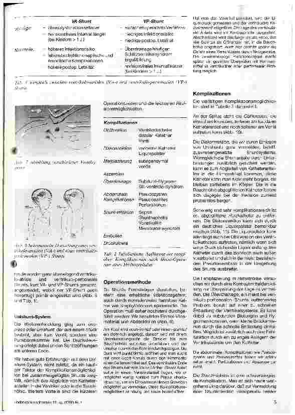 Vorschauseite 3: Hydrozephalus als assoziierte Fehlbildung
