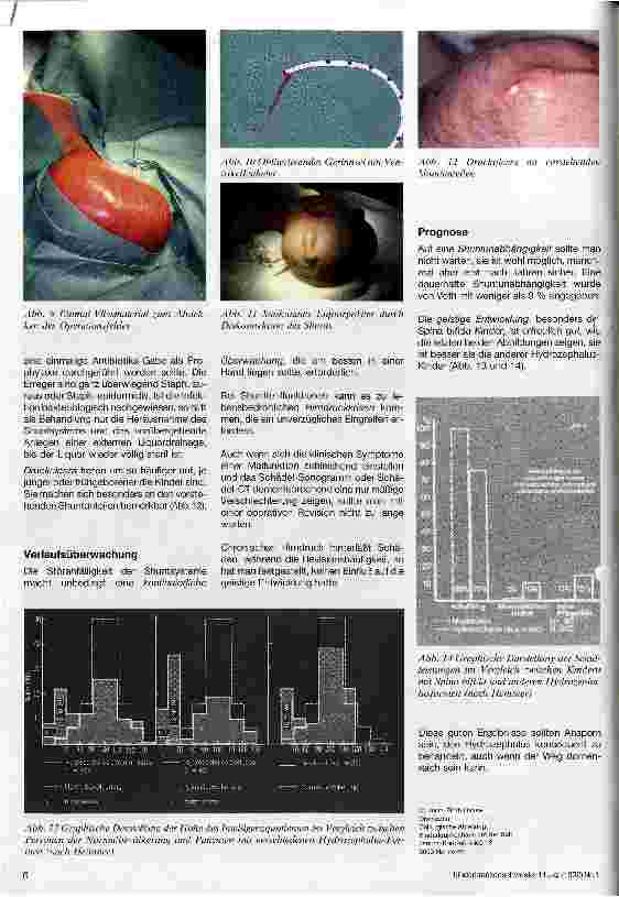 Vorschauseite 4: Hydrozephalus als assoziierte Fehlbildung