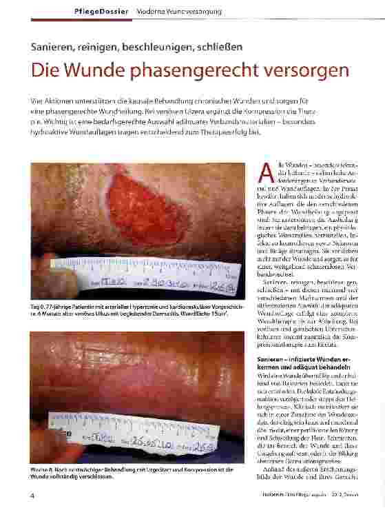 Vorschauseite 1: Die Wunde phasengerecht versorgen