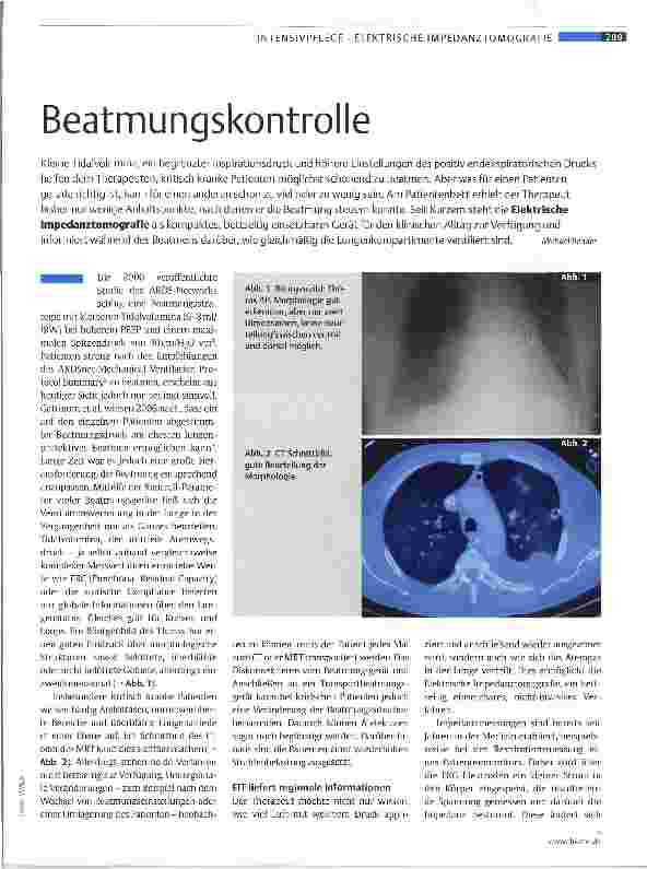 Vorschauseite 1: Beatmungskontrolle