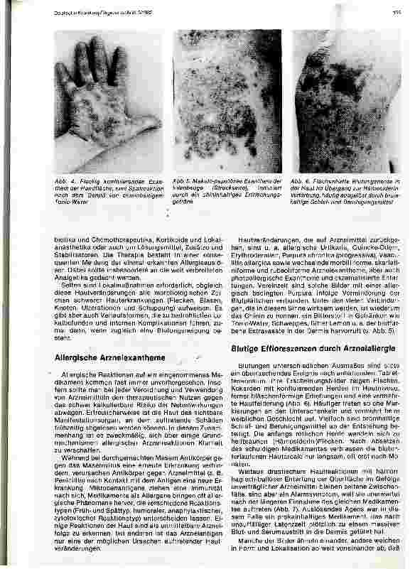 Vorschauseite 3: Die Kinderkrankenpflege Kontaktdermatitis und Arzneiexanthem