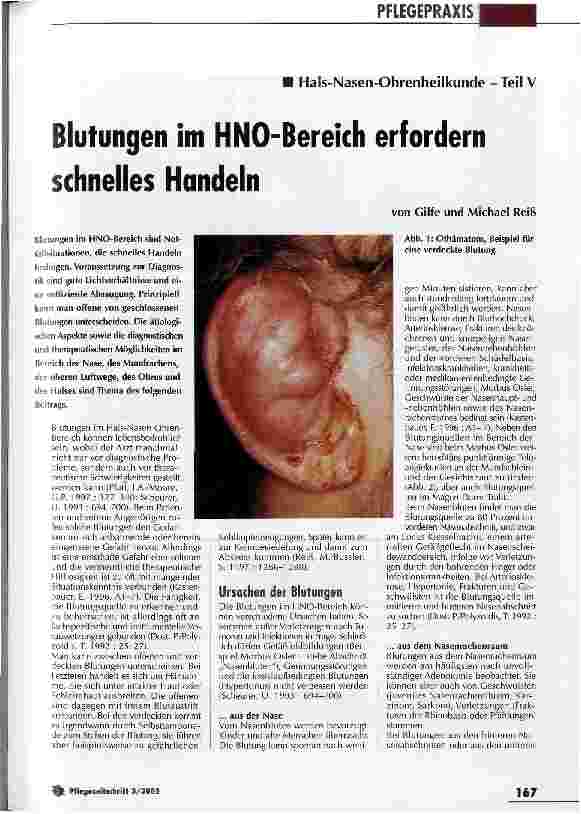Vorschauseite 1: Blutungen im HNO-Bereich erfordern schnelles Handeln Hals-Nasen-Ohrenheilkunde - Teil V