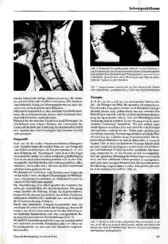 Vorschauseite 4: Die Spinalkanalstenose