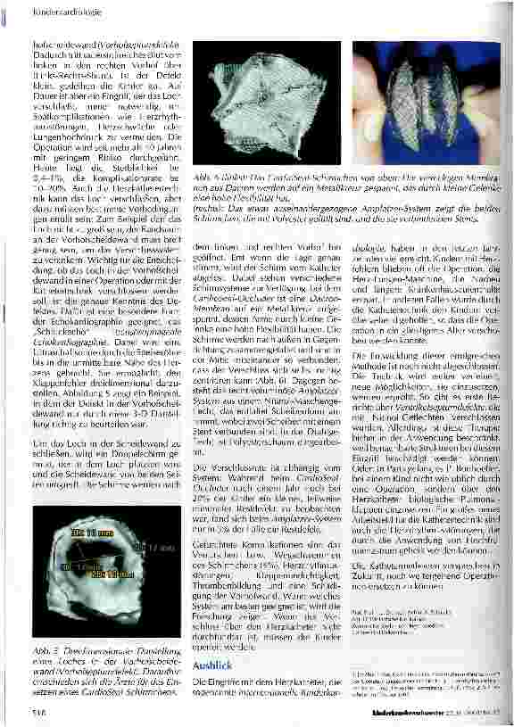 Vorschauseite 4: Rettende Eingriffe: interventionelle Kinderkardiologie
