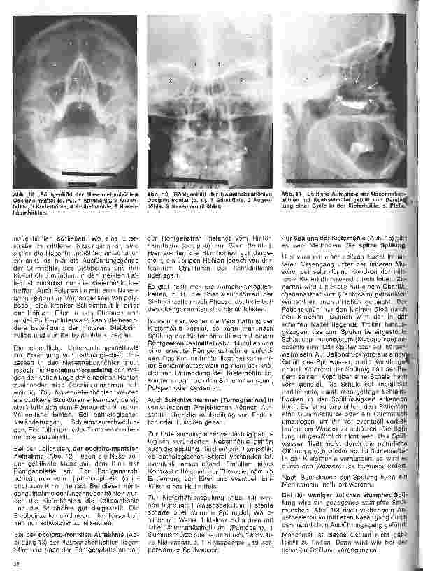Vorschauseite 5: Einführung in die Hals-Nasen-Ohren-Heilkunde 7.Folge: Anatomie und Physiologie der Nase // Untersuchungsmethoden und Funktionsprüfung
