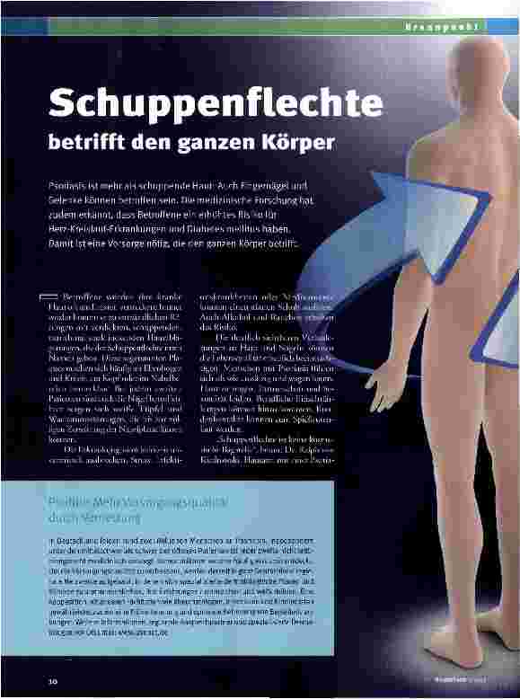 Vorschauseite 1: Schuppenflechte