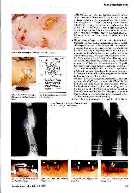 Vorschauseite 4: Pflege polytraumatisierter Patienten anhand eines Fallbeispiels