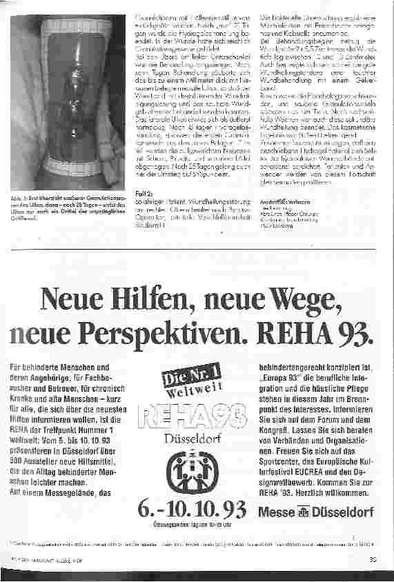 Vorschauseite 2: Hydrogelverband - erstmals völlig transparent