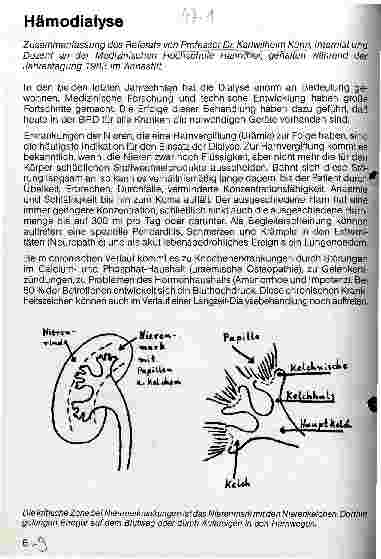 Vorschauseite 1: Hämodialyse
