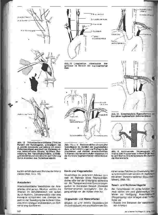 Vorschauseite 4: Gefäßkrankheiten Ursachen - Auswirkungen - Behandlung