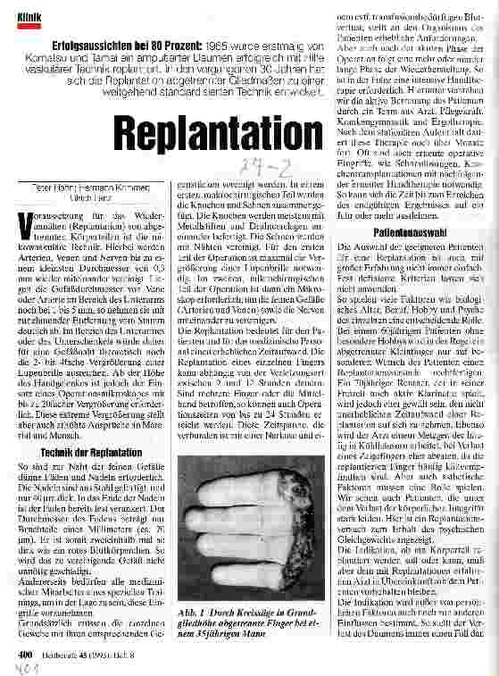 Vorschauseite 1: Replantation Erfolgsaussichten bei 80 %