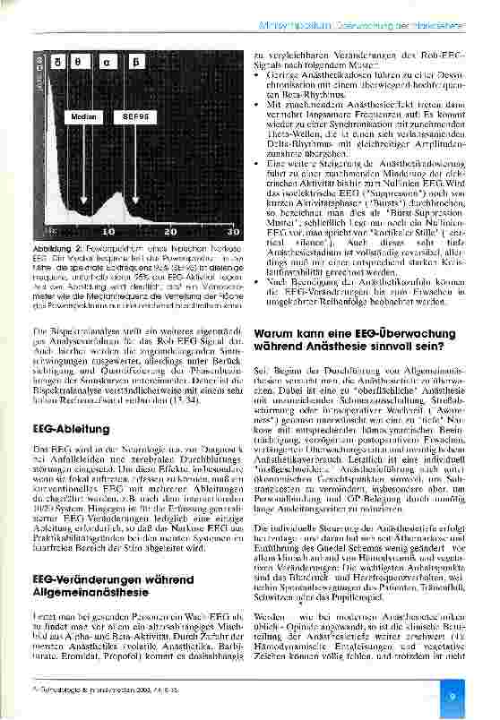 Vorschauseite 2: Das interpretierte EEG als Überwachungsverfahren in der Anästhesiologie