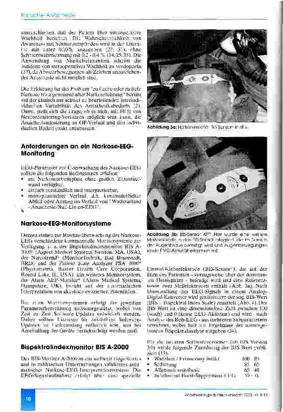 Vorschauseite 3: Das interpretierte EEG als Überwachungsverfahren in der Anästhesiologie