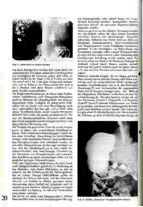 Vorschauseite 2: Klinik und Therapie: Gastro-duodenal Ulcus