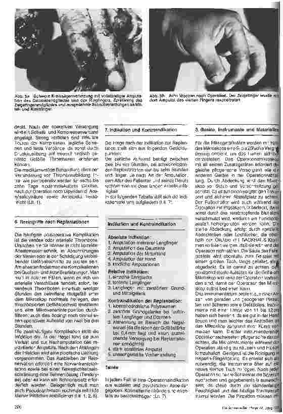 Vorschauseite 3: Aktuelle Aspekte der Handchirurgie nach Einführung der Mikrogefäßchirurgie
