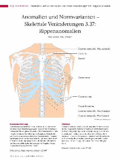 Vorschauseite 1: Anomalien und Normvarianten – Skelettale Veränderungen 3.37: Rippenanomalien