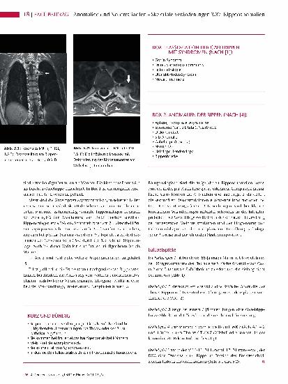 Vorschauseite 3: Anomalien und Normvarianten – Skelettale Veränderungen 3.37: Rippenanomalien