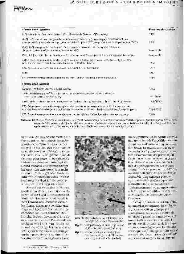 Vorschauseite 3: Prionen - eine Herausforderung der Hygieia