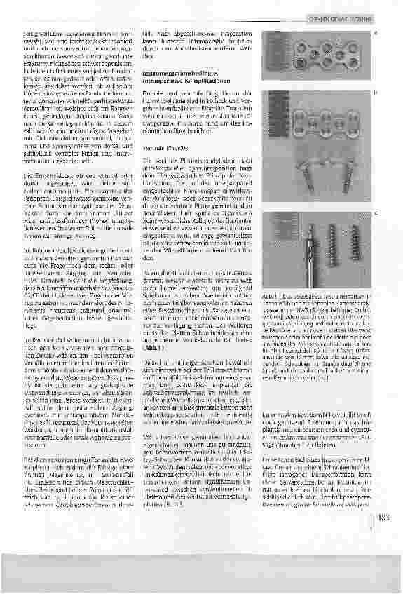 Vorschauseite 2: Lösungsmöglichkeiten nach fehlgeschlagenen Spondylodesen an der Halswirbelsäule