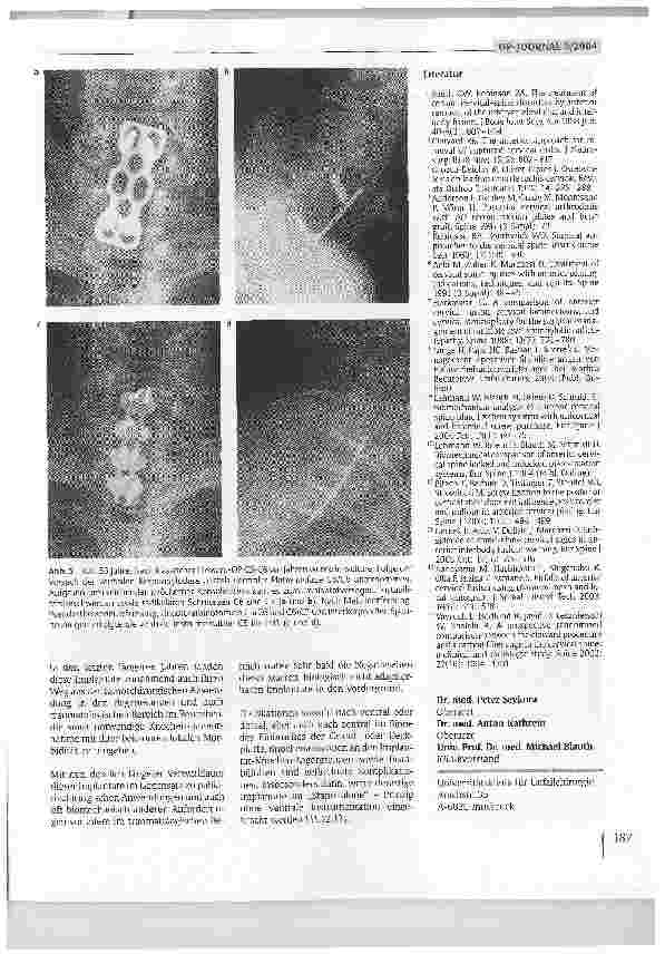 Vorschauseite 6: Lösungsmöglichkeiten nach fehlgeschlagenen Spondylodesen an der Halswirbelsäule