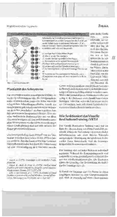 Vorschauseite 3: Leben nach einem Schlaganfall