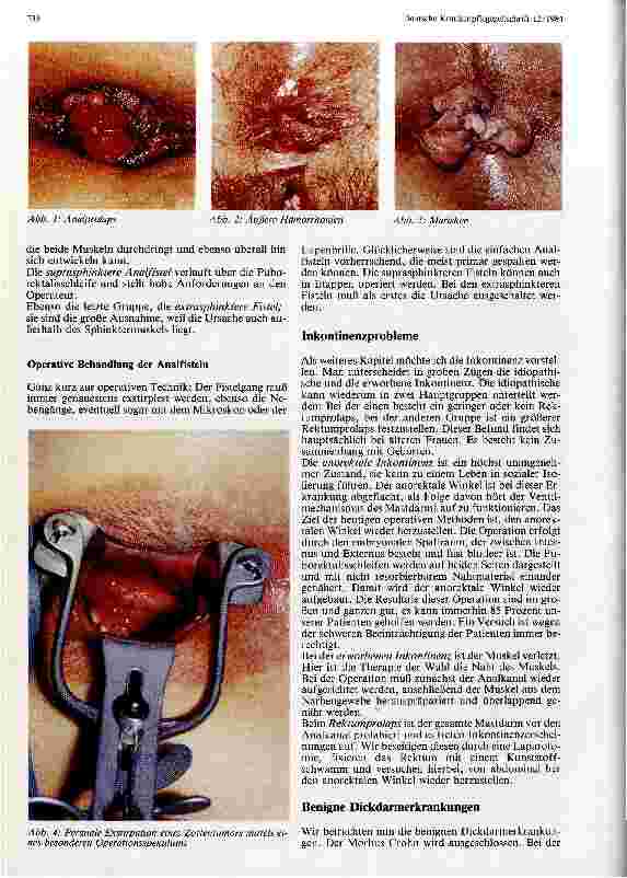 Vorschauseite 2: Moderne Enddarmchirurgie