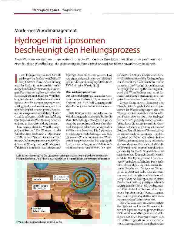 Vorschauseite 1: Hydrogel mit Liposomen beschleunigt den Heilungsprozess