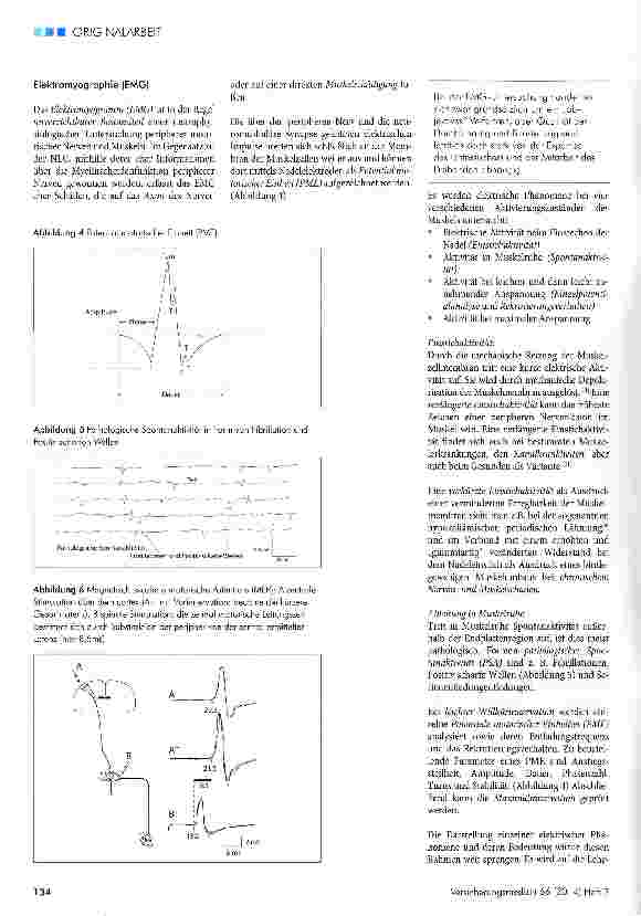 Vorschauseite 3: Möglichkeiten und Grenzen der klinischen Neurophysiologie zur Objektivierung neurologischer Unfallfolgen