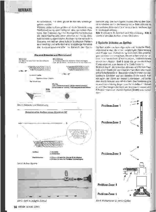 Vorschauseite 3: MPG und starre Optiken