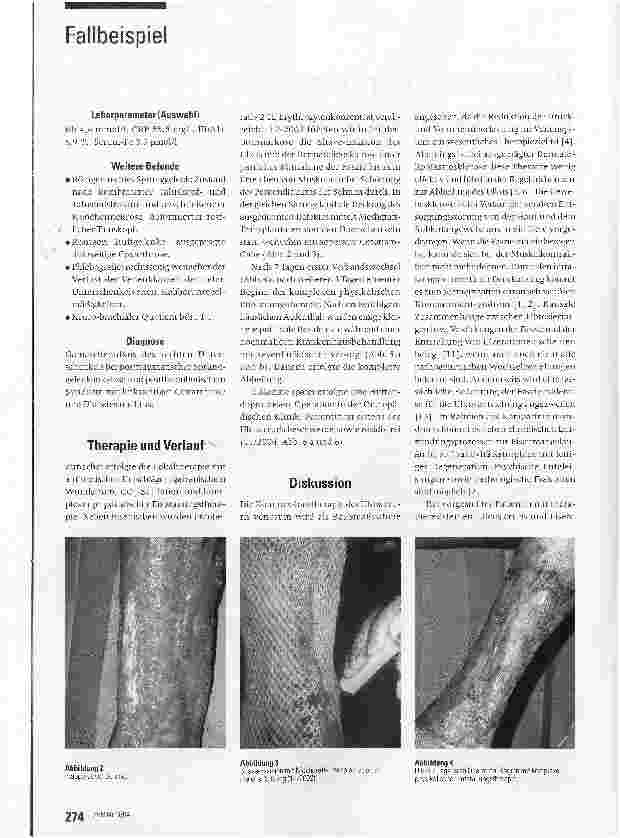 Vorschauseite 2: Operative Therapie des venösen Ulcus cruris