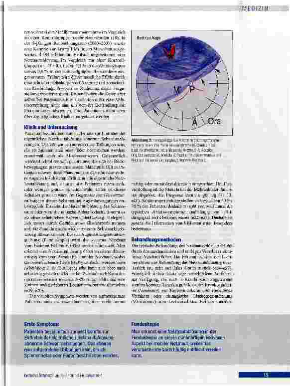 Vorschauseite 4: Rissbedingte Netzhautablösung -ein ophthalmologischer Notfall